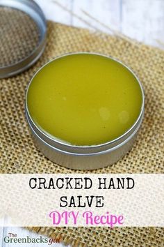 Hand Cream Homemade, Hand Salve, Cracked Hands, Diy Kosmetik, Hand Creams