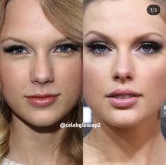 Celebrity Before And After Surgery, Celebrity Before And After, Celebrities Before And After Surgery, Sea Before And After Surgery, Taylor Swift Before And After, Taylor Swift Nose Job, Canthoplasty Before And After, Nose Plastic Surgery Before After, Before And After Plastic Surgeries