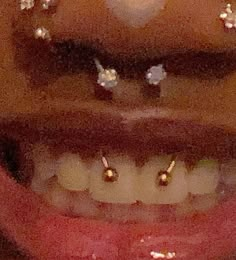 a woman's mouth with gold and white diamond studs on the top of her teeth