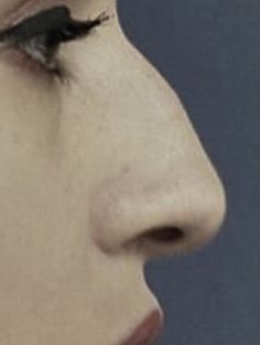 a woman's nose is shown with the tip of her nose slightly bent up