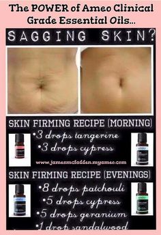 Skin Tips For Acne, Herbal Body Oil, Skin Tightening Essential Oil, Sagging Skin Remedies, Body Oil Recipe, Tips For Acne, For Skin Tightening, Fat Oil, Skin Cream Anti Aging