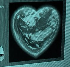 an image of a heart on a computer screen