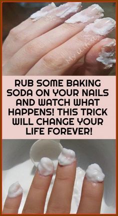 Rub Some Baking Soda On Your Nails And Watch What Happens? This Trick Will Change Your Life Baking Soda Nails, Milky Nails, Health Hacks, Nail Fungus, Diy Health, Nail Brushes, Peppermint Essential Oil, Change Your Life, Healthy Tips