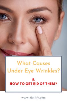 How To Get Rid of Under Eye Wrinkles Naturally & What Causes Wrinkles Under Eyes Wrinkles Under Eyes, Soup Pork, What Causes Wrinkles, Blind Pimple, Wellness Board, Pimples Under The Skin, Eye Wrinkles, Body Stretch