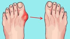 a person with red spots on their toe and toes, showing the area where it is located