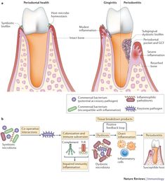 the stages of tooth decay are shown in this diagram, and there is no image to describe