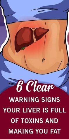 Health Signs, Liver Detox, Proper Diet, Sendai, Health Facts, Health Awareness, Warning Signs, Health Remedies, Natural Healing