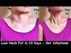 a woman's neck is shown before and after surgery