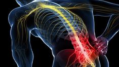 Back pain is one of the most common problems faced by people worldwide. It can have a variety of causes, including muscle strains, spinal injuries, or problems with the nervous system. In this article, we will focus on nerve pain in the back, looking at its causes, symptoms, prevention, and treatment. Rotator Cuff Injury, Disk Herniation, Sciatic Nerve Pain, Sciatica Pain, Rotator Cuff, Sciatic Nerve, Personal Injury Lawyer, Nerve Pain