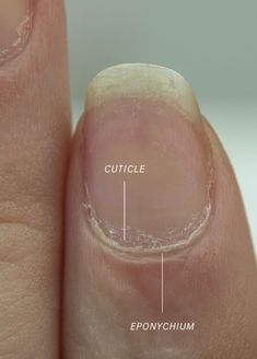 Cuticle Q+A with the founder of Bare Hands White Toes Nail, Spring Nails Ideas, Sharp Nails, Cuticle Care, Cuticle Remover, Stomach Problems, Popular Nail Designs, Nail Cuticle, Trending Nail Designs