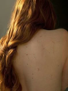 the back of a woman's head with freckles on her skin and hair