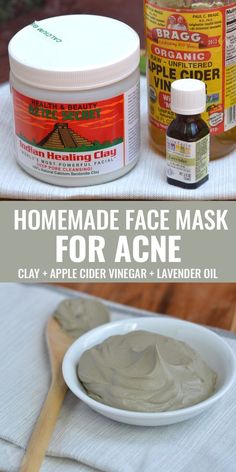 Simple homemade face mask for acne! Mix 1 tbsp bentonite clay + 1 tbsp apple cider vinegar + 1 drop lavender oil and apply to face for 30 minutes. Great for face mask, or spot treatment! Homemade Face Mask For Acne, Homemade Face Mask, Acne Remedies