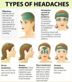 Types of Headaches More Different Types Of Headaches, Bolesti Chrbta, Headache Types, Reiki Meditation, Migraine Relief, Headache Relief, Migraine Headaches, Medical Knowledge, Health Info