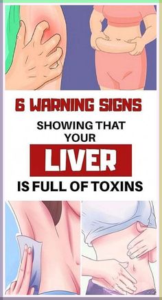 CHECK YOUR BODY: Warning Signs That You Have a Fatty Liver Ways and How to Cleanse It Warning Signs, Signs