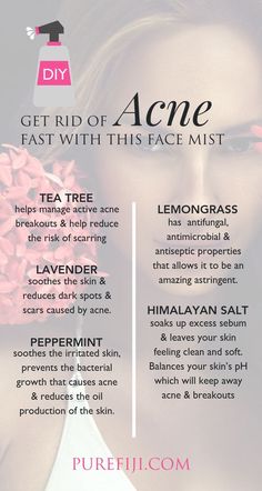 Skin Care Routine For 20s, Diy Acne, Natural Skin Care Products, Lemongrass Essential Oil, Peppermint Tea, Makeup Tricks, How To Get Rid Of Acne, Face Mist, Virgin Coconut Oil