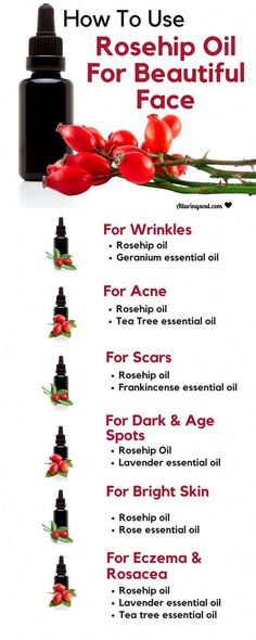 Dark Spots Products, Rosehip Oil Benefits, Oils For Scars, Lotion For Oily Skin, Baking Soda Shampoo, Geranium Essential Oil, Frankincense Essential Oil, Natural Cough Remedies, Rose Essential Oil