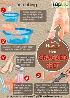 Cracked Heel Remedies, Diy Pedicure, Pedicure At Home, Healthy Routine, Beauty Skin Care Routine