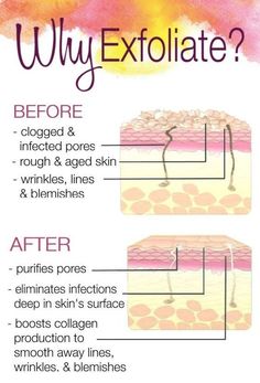 Face Tightening, Skin Facts, Pore Cleanser, Peeling Skin, Wrinkled Skin, Skin Cleanser Products, Face Skin Care, Beauty Skincare, Skin Tips