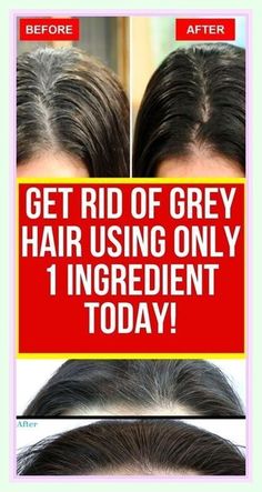 Grey Hair Remedies, Gray Hair, Grey Hair, Silver Hair, Natural Food, White Hair, Hair Growth, Home Remedies, Fat Burning