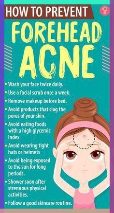 To get rid of blackheads, consider using elements such as salicylic acid, lactic acid, citric acid, or glycolic acid. Aim to use a cleanser with a concentration of 10% for these acids.
#fallskincare #blackheadremoval #autumnskincare #clearskin #porecleansing #fallbeauty #skincaretips #blackheadtreatment #seasonalskincare #fallglow Pimples On Forehead, Forehead Acne, Pimples Under The Skin, Bad Acne, Acne Overnight, Sunday Routine, Prevent Pimples, Acne Face Wash, Natural Acne Remedies