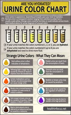 the color chart for urine is shown in this poster