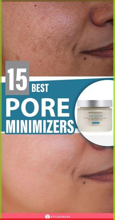 15 Best Pore Minimizers: You cannot make the pores go away. However, some pore treatment products help deep cleanse and shrink them. If you are not sure which product to buy, we have a few recommendations. Here are the 15 best pore minimizer products to help get flawless, glowing skin. Check them out! #Pores #Skinpores #Beauty #BeautyTips Best Pore Minimizer, Forehead Acne, Lotion For Oily Skin, Pore Minimizer, Oily Skin Acne, Face Cream Best, Best Face Wash