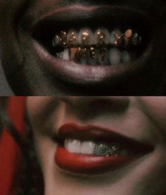 two pictures with teeth and braces on them, one is black and the other is red