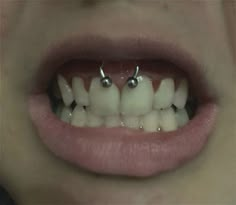 a woman's mouth with two piercings on the top of her teeth, and one missing