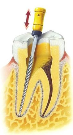 Dental Photos, Dental Images, Dental Photography, Dental Anatomy, Dental Design, Emergency Dentist