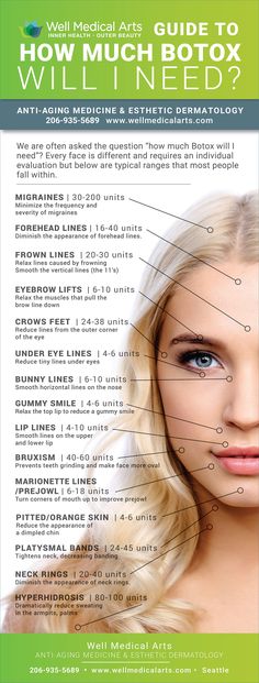 Facial Fillers, Cosmetic Treatments