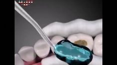 Think You(76worldtelevision) Dental Cavities, Productive Day, Cavities, Gap