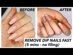 Dip Powder Pedicure Ideas, How To Get Dipped Nails Off At Home, How To Take Off Dipped Nails At Home, How To Remove Tips Nails At Home, Remove Sns Nails At Home, Diy Sns Nails At Home, Remove Dipped Nails At Home, How To Remove Dipped Nails At Home, Nail Removal