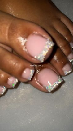 Pedicure Designs Toenails, Nail Problems, Gel Toe Nails, Acrylic Toe Nails, Pretty Toe Nails, Cute Toe Nails, Summer Toe Nails, Nail Care Tips, French Acrylic Nails