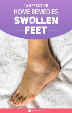 Sore Feet Remedies, Natural Headache, Natural Headache Remedies, Home Health Remedies, Health Advice