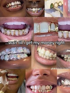 many different types of teeth with braces and piercings on them, all in various pictures