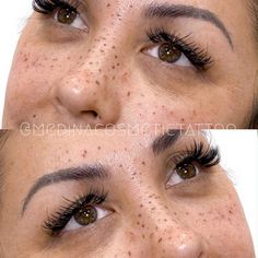 two pictures of the same woman's eyes with freckles