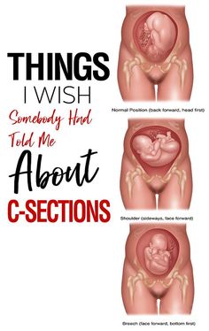 an image of the stomach and abdomen with text that reads things i wish somebody had told me about c - sections