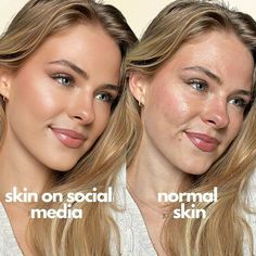 Filter Is Not Real Life Real Skin Texture, Face Mapping Acne, Eyeliner Techniques, Real Skin, Celebrity Skin, Swag Girl Style, Face Acne, Perfect Relationship