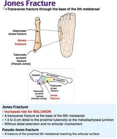 an image of the bones and their functions in human anatomy, with text below it