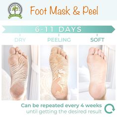 Our Foot Mask & Peel is an exfoliating mask that removes dry, cracked from your foot, leaving behind soft skin on your feet. Go ahead, pamper yourself. Each pack contains 1 pair of foot peels. Ingredients: Aqua, Citric Acid, Aloe Vera, Malic Acid, Sorbitol, Papain, Salicylic Acid.  Our products contain NO: parabens, sulfates, sls, silicones, mineral oil, petroleum, lanolin, methylchloroisothiazolinone (MI).  We only use certified organic and/or vegan materials in our products. Instructions: Wash Foot Mask Peel, Foot Peel Mask, Ear Reflexology, Chemical Exfoliation, Peeling Mask, Rough Heels, Exfoliating Mask, Foot Mask, Cracked Heels