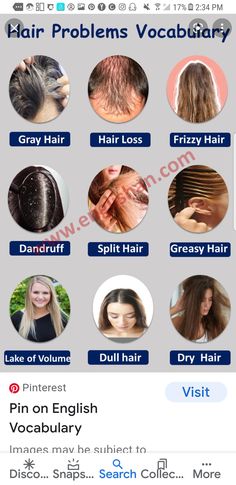 an image of hair problems on the webpage, which shows different types of hair