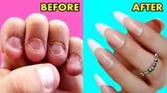 How To GROW Long Strong Nails Fast At Home - Making Nails Strengthener Serum with home supplies#nails #grownailsfast #nailsstrengthener Nails Strengthener, Make Nails Grow, Making Nails, How To Grow Nails