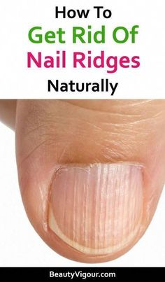 How to get rid of nail ridges naturally... Ridges In Nails, Nail Health Signs, Nail Ridges, Nails November, Nail Growth Tips, 2023 Nail, Nail Problems, November Nails, Health Signs