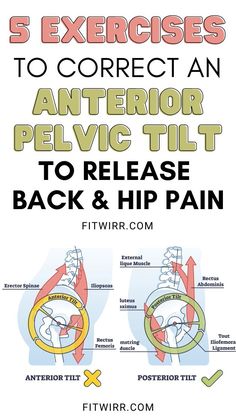 The pin features graphics that show hips that have an anterior pelvic tilt and hips that have the correct posterior tilt. Those two graphics show the differences it creates in the body alignment. The pin also has the pin title "5 Exercises to Correct an Anterior Pelvic Tilt to Release Back and Hip Pain". Low Impact Strength Training, Hip Alignment, Posture Correction Exercises, Forward Head Posture Exercises, Hip Strengthening Exercises, Hip Flexor Exercises