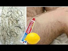 In 5 Minutes Remove Unwanted Hair Permanently, Painlessly Remove Unwanted Hair NaturallyＬＩＫＥ | ＣＯＭＭＥＮＴ | ��ＳＨＡＲＥ | ＳＵＢＳＣＲＩＢＥ & Must Click on notification bell.... Waxing Vs Shaving, Natural Hair Removal Remedies, Ayurvedic Hair Care, Hair Remove, Hair Removal Diy, Unwanted Hair Permanently, Natural Hair Removal, Honda C70, Remove Unwanted Hair