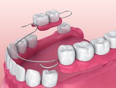 Book Now Appointment, Dental Retainer, Dental Exam, Dental Fillings, Loose Tooth, Tooth Sensitivity