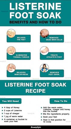 Foot Soak Recipe, Bad Acne, Natural Skin Care Remedies, Home Health Remedies, Skin Dryness, Vie Motivation, Skin Care Remedies