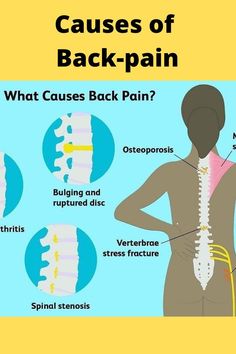 Backpain Breakthrough is a program designed to help relieve chronic back pain through a combination of targeted exercises and movements. #backpain#breakthrough#reviews#price#usa#canada#uk#australia#relief#trending#viral Targeted Exercises, Calf Cramps, Human Back, Chronic Back Pain, Causes Of Back Pain, Lower Back Pain Exercises, Upper Back Pain