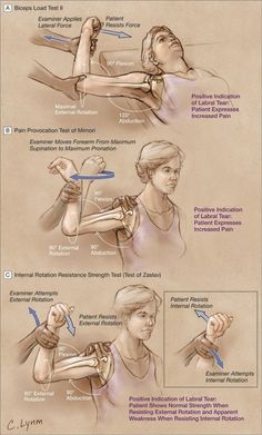 Shoulder Instability or Labral Lesion? #StopThatAnnoyingBackache! #PsoasRelease Shoulder Instability, Massage Therapy Techniques, Hand Therapy