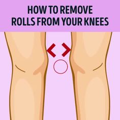 how to remove rollers from your knees